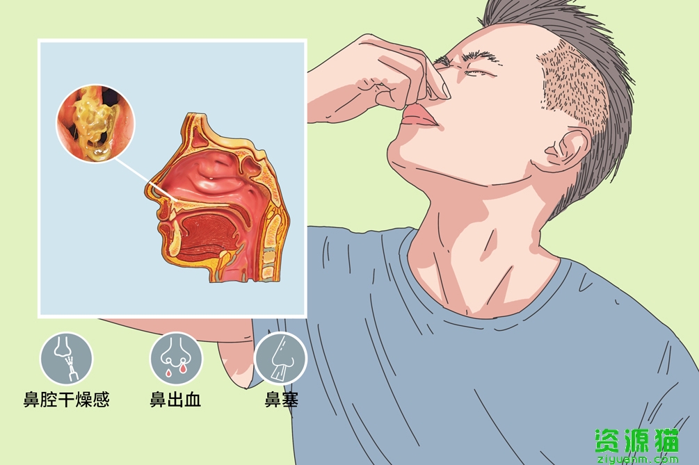 中耳炎必须要吃抗生素吗