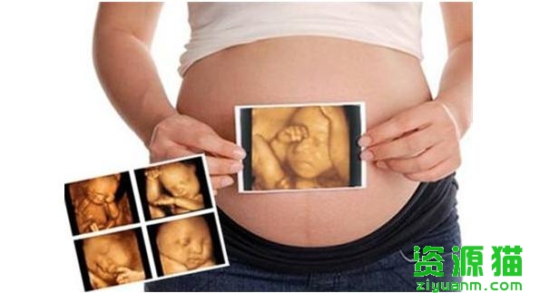 b超单子看胎儿识别准确度多少（想要辨别胎宝宝性别）(1)