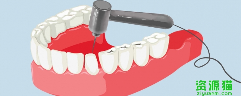 洗牙对牙有伤害吗 洗牙影响牙齿健康吗